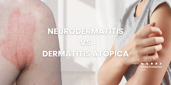 ¿Cuál es la diferencia entre neurodermatitis y dermatitis atópica?