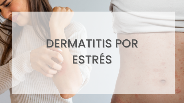 Qué es la dermatitis por estrés y cómo combatirla