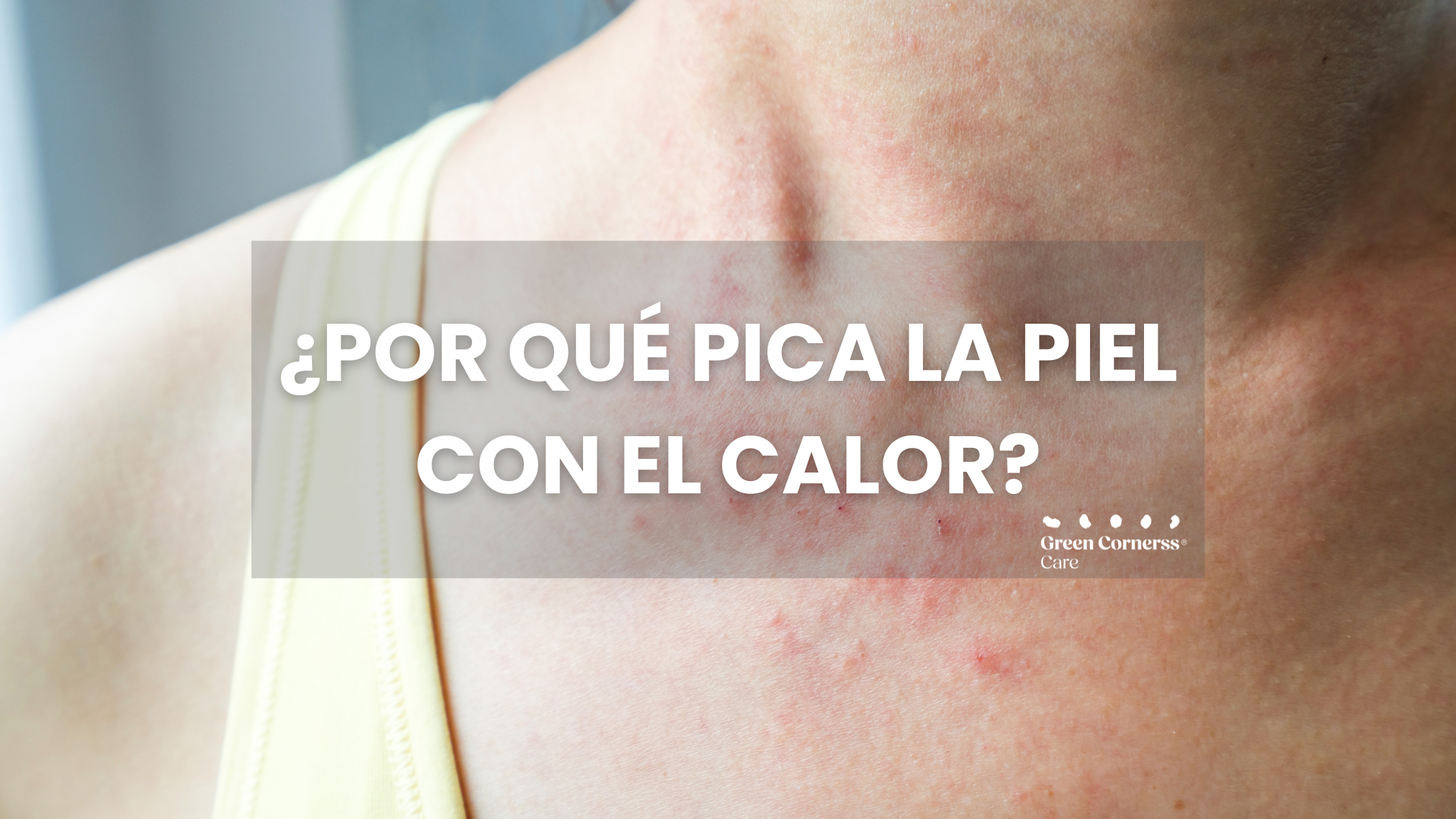 Picor en la Piel por Cambio de Temperatura: Causas y Cómo Aliviarlo