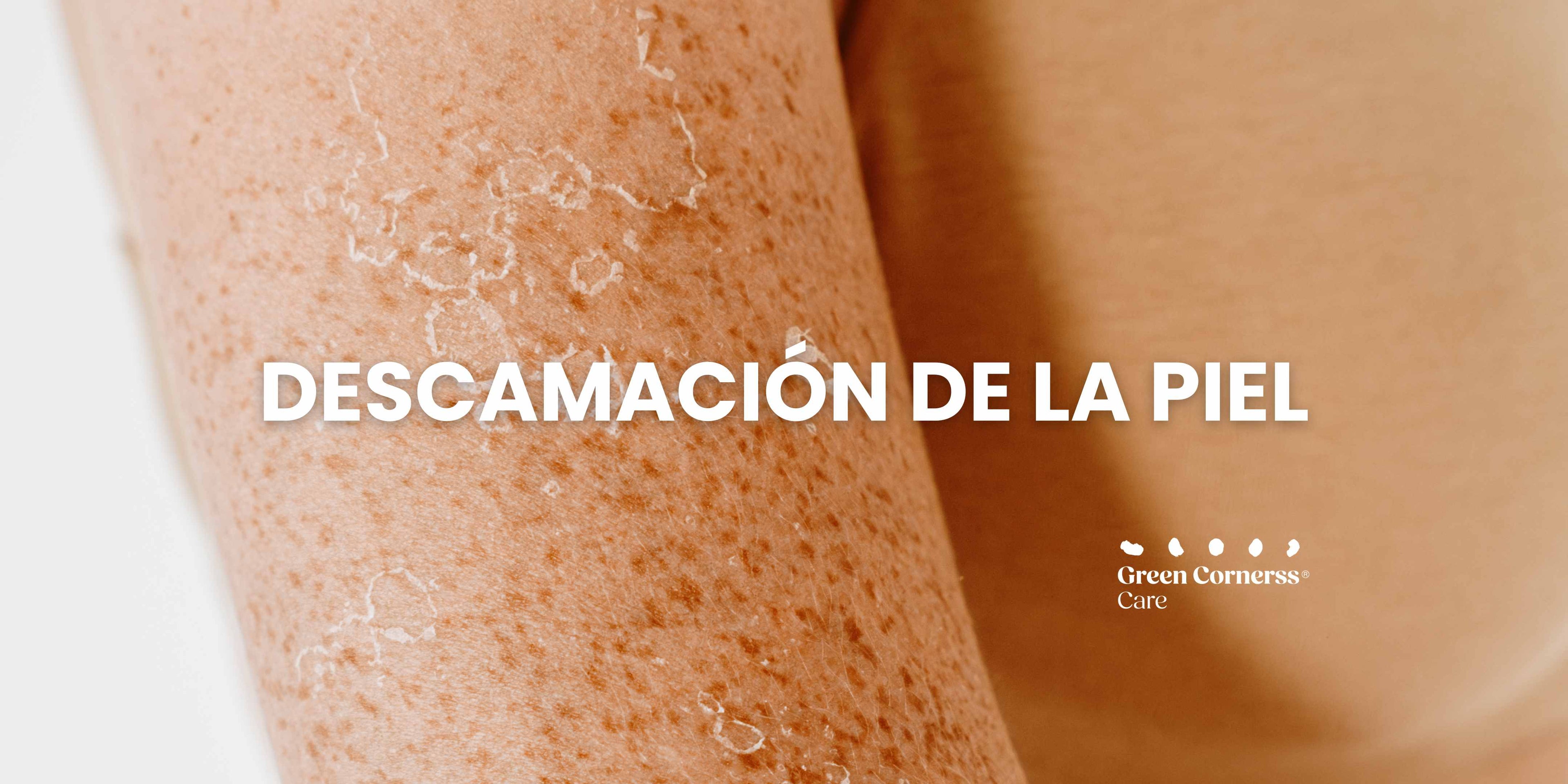Descamación de la piel: ¿Cómo debo tratarla?