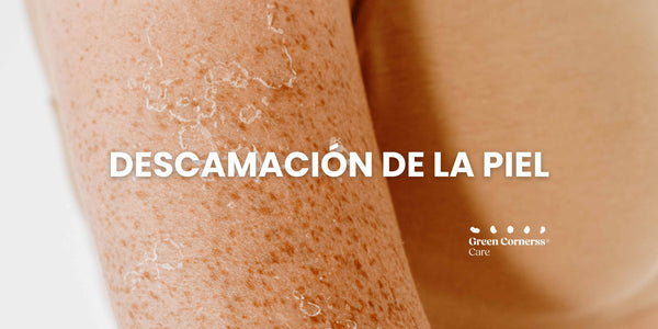 Descamación de la piel: ¿Cómo debo tratarla?