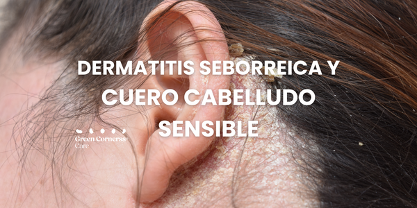 Dermatitis Seborreica en el Cuero Cabelludo: Que es y Como Tratarla