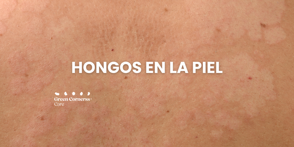 Hongos en la piel: ¿Cómo identificarlos y cómo tratarlos? Pitiriasis versicolor