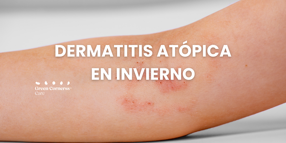¿Por qué empeora la dermatitis atópica en invierno?