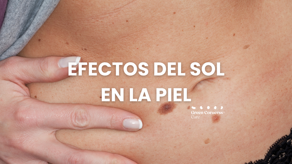 Efectos del sol en la piel: Identificación y prevención