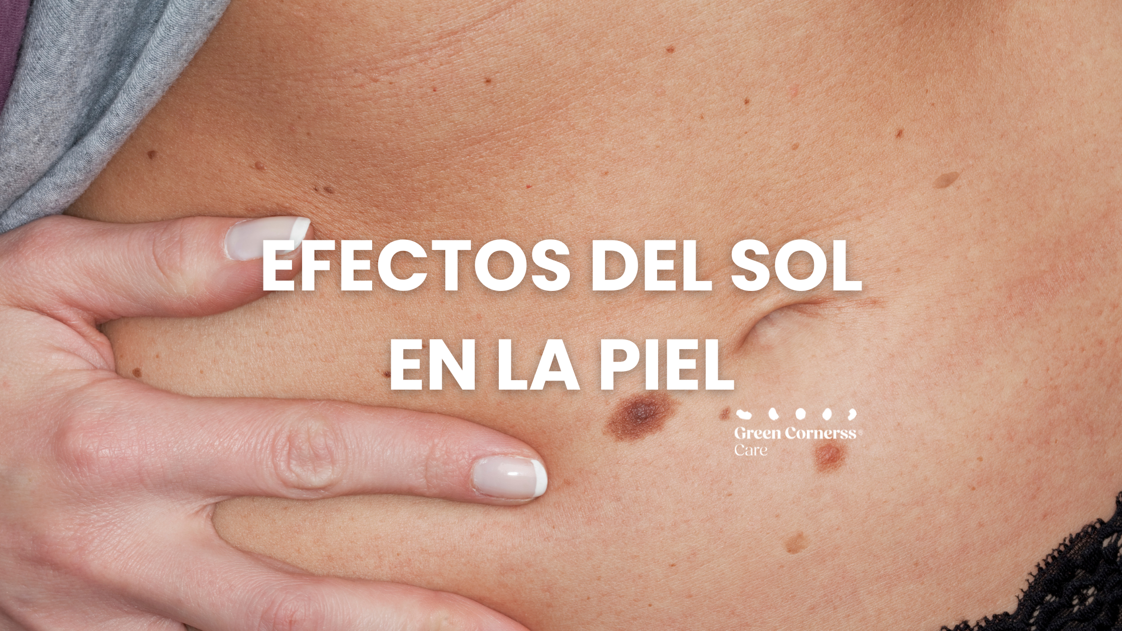 Efectos del sol en la piel: Identificación y prevención