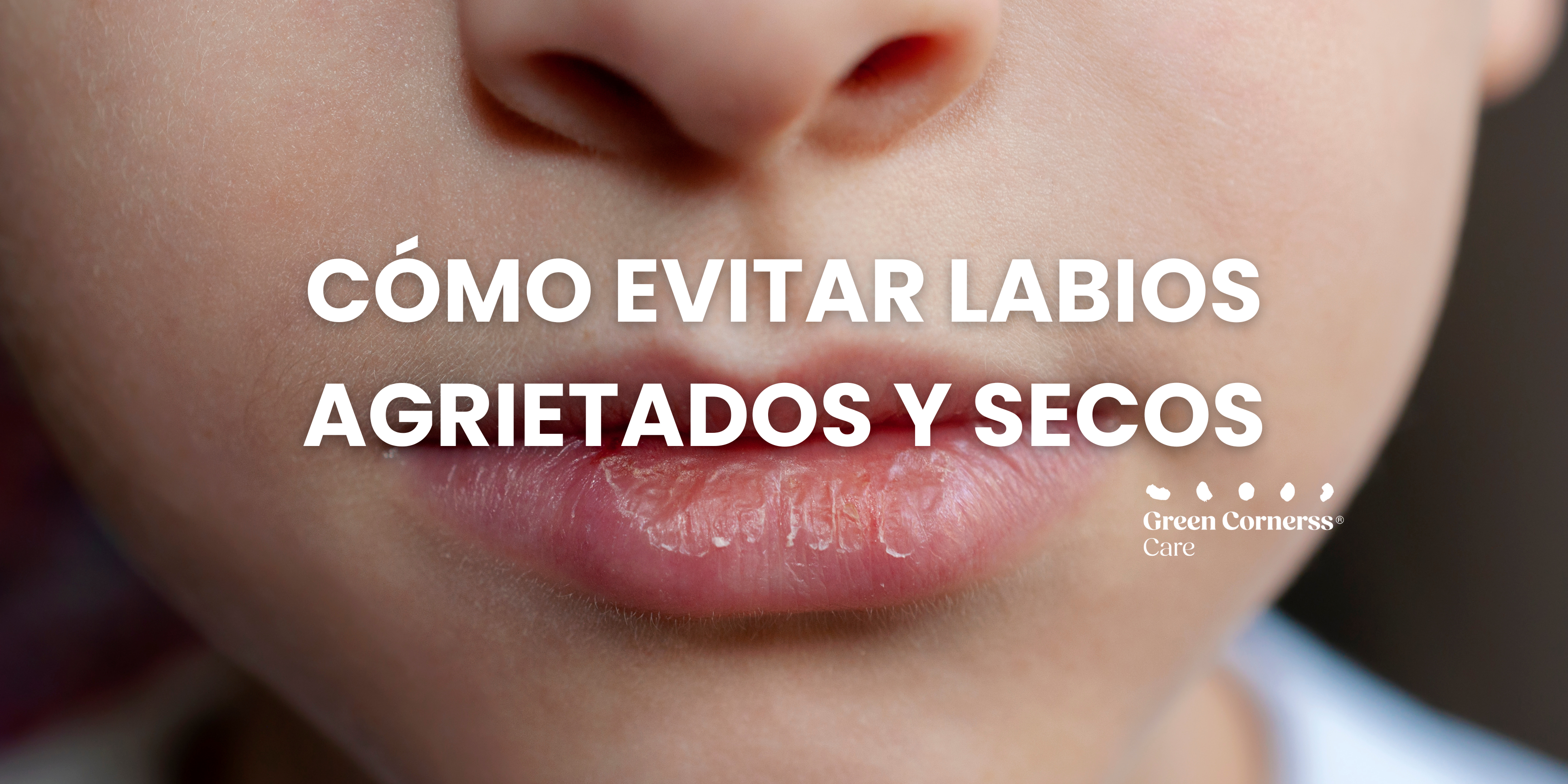 Cómo evitar los labios agrietados y secos con la llegada del frío.