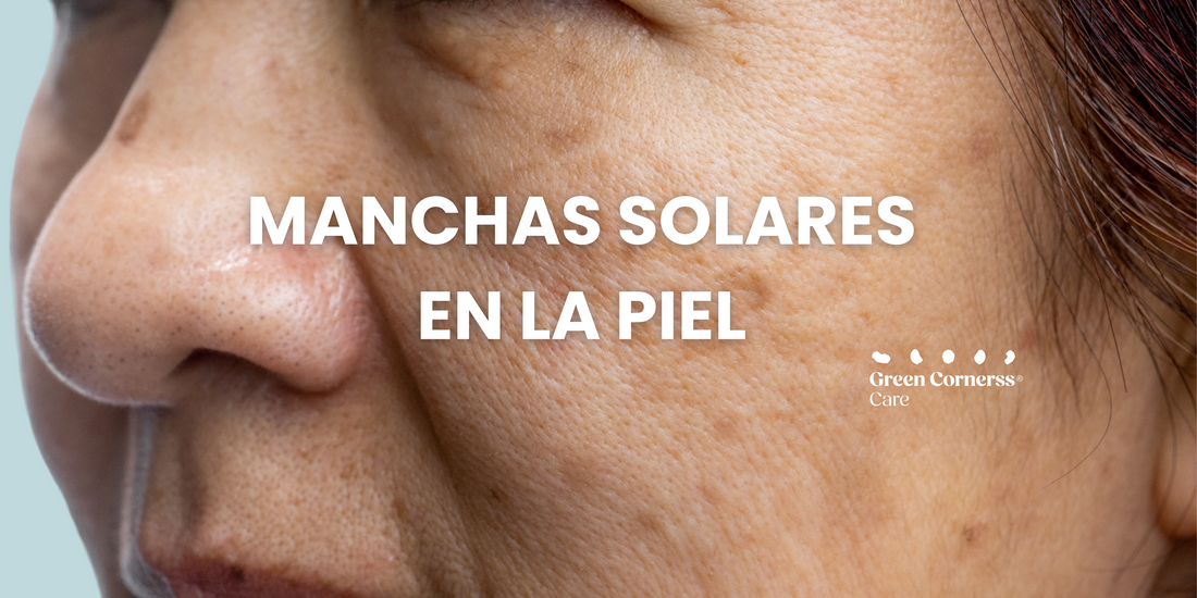 Manchas solares cara