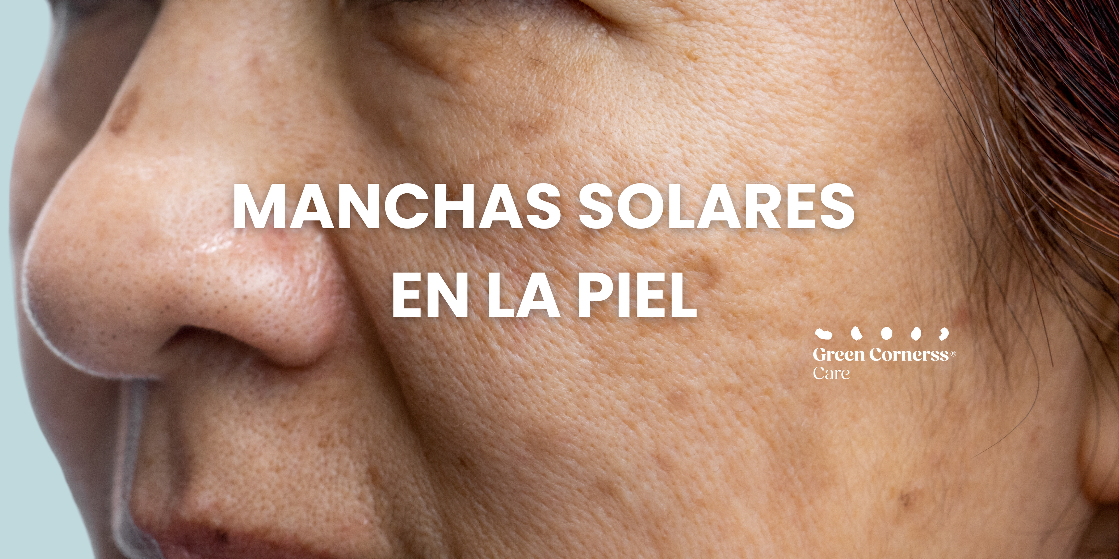 Manchas solares cara