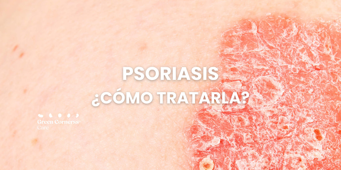 ¿Cómo tratar la Psoriasis en la piel?
