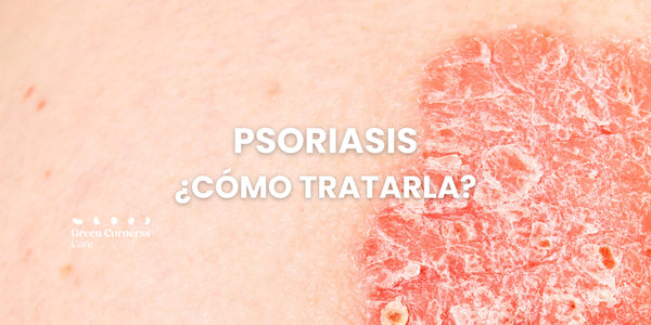¿Cómo tratar la Psoriasis en la piel?