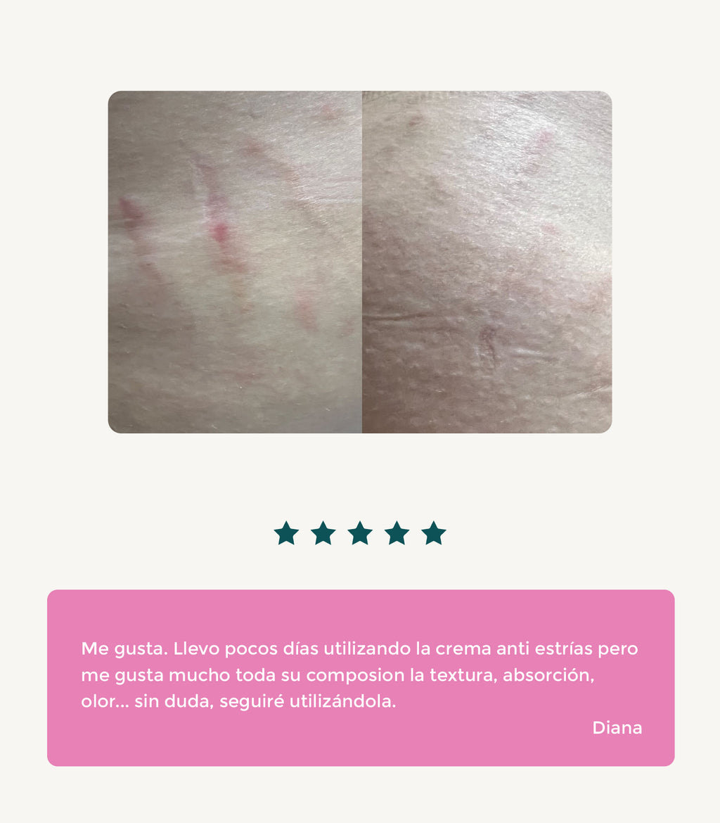 Crema anti-estrías con sangre de dragón
