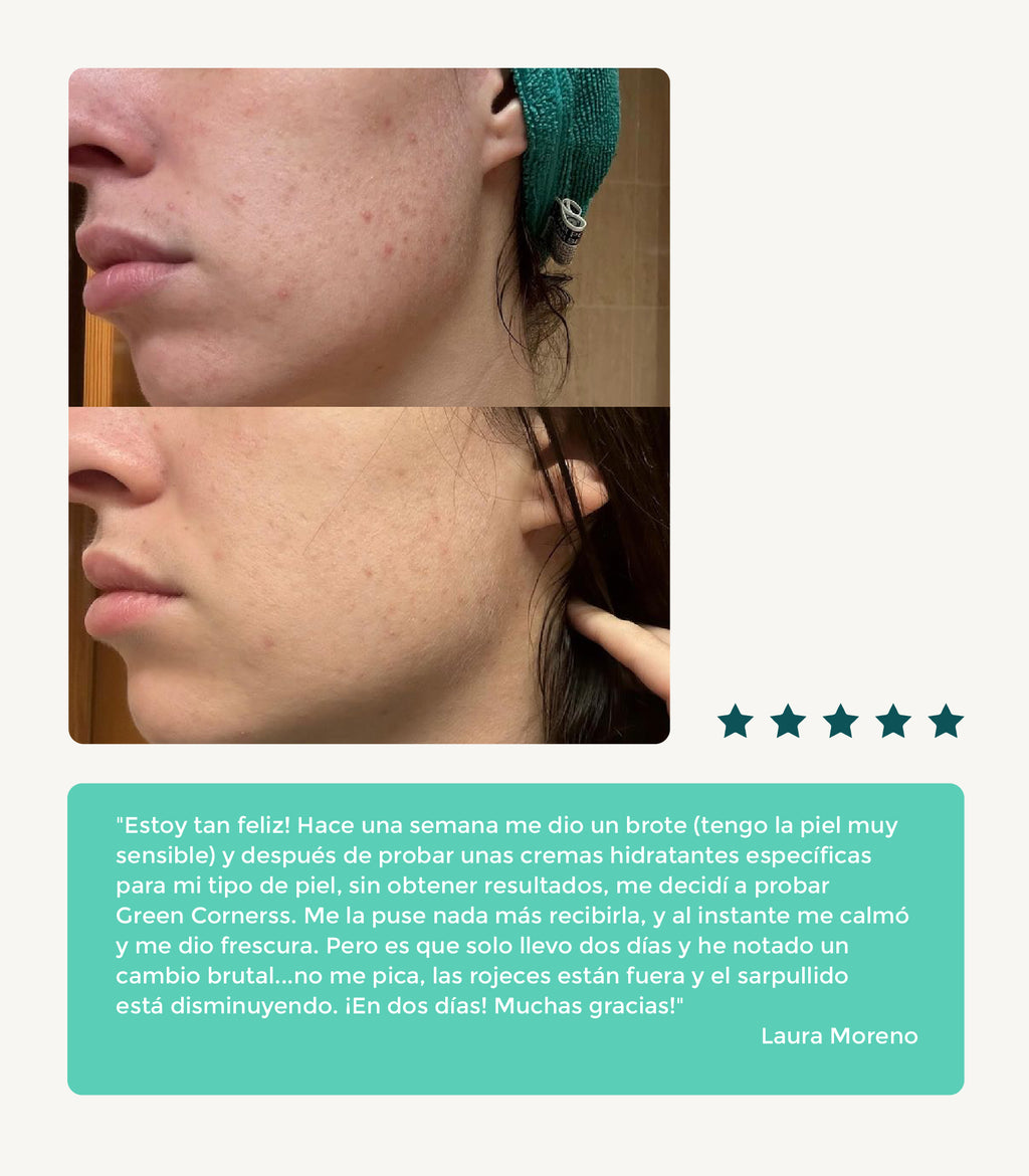 Crema facial de repollo